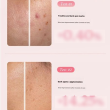 Load image into Gallery viewer, Medicube PDRN Pink Hyaluronic Moisturizing Cream (1.69 Oz)