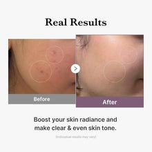 Load image into Gallery viewer, medicube Age-R Glutathione Glow Milky Toner, Low-Irritation Double Layer Toner for Glass Glow Skin with Peptide, Even Skin Tone, Radiance, Hydration, Korean Skincare

