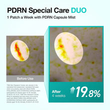 Load image into Gallery viewer, ANUA Salmon DNA PDRN Collagen Melting Patch for Glass skin, Smile Line Patches, Wrinkle Patches, Melting Thin Collagen Patch, Firming for Fine Lines, Glow, Korean Skincare, 2 Pairs x 4EA, Patch Only
