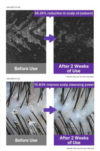 Load image into Gallery viewer, 두피타이트닝 탈모샴푸 완벽더블( 4 BOX) -Dr. Oracle Scalp Pore Control Shampoo 380 ml -2027/05/13-
