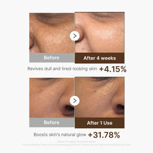Load image into Gallery viewer, Medicube Deep Vitamin C Capsule Serum | Hydrating Facial Serum for Dull &amp; Uneven Looking Skin | Liposome Vitamin Capsules for Radiant &amp; Smooth Skin Texture | Korean Skincare, 1.01 fl oz
