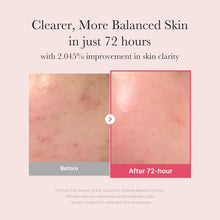 Load image into Gallery viewer, Medicube - TXA Niacinamide 15 Serum (30ml)

